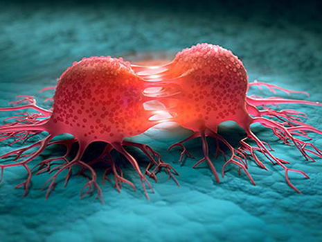  سرطان چیست و چگونه ایجاد می‌شود؟