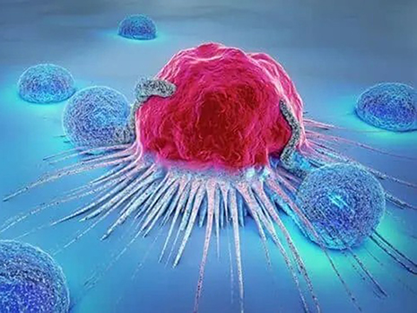 🧬 علائم اولیه سرطان که نباید نادیده گرفت